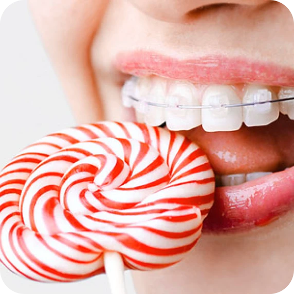 Alimentation et appareil dentaire, que faut-il faire ? Conseils du Dr Ohayon