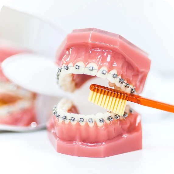 Сonseils d'hygiène bucco-dentaire au Cabinet d'Orthodontie du Dr Jérémy Ohayon