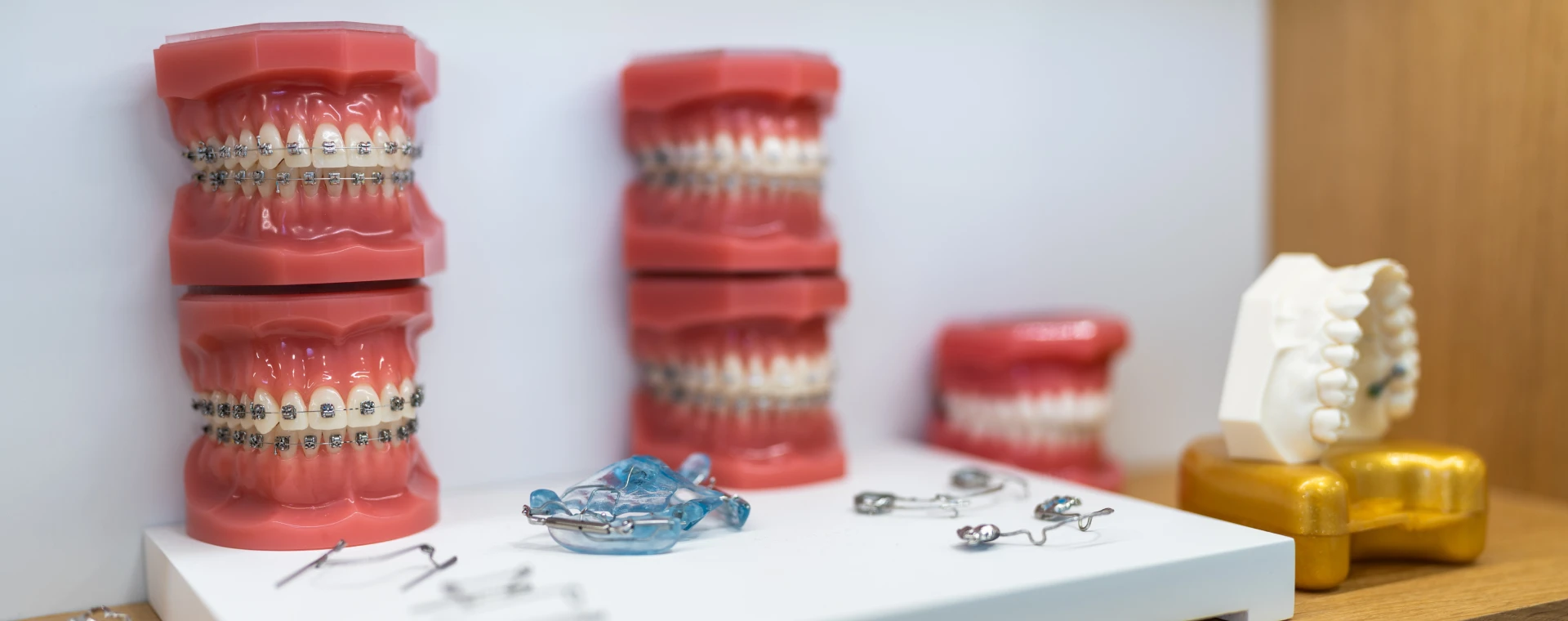 Appareils orthodontiques au cabinet du Dr Jérémy Ohayon, spécialiste en orthodontie à Strasbourg